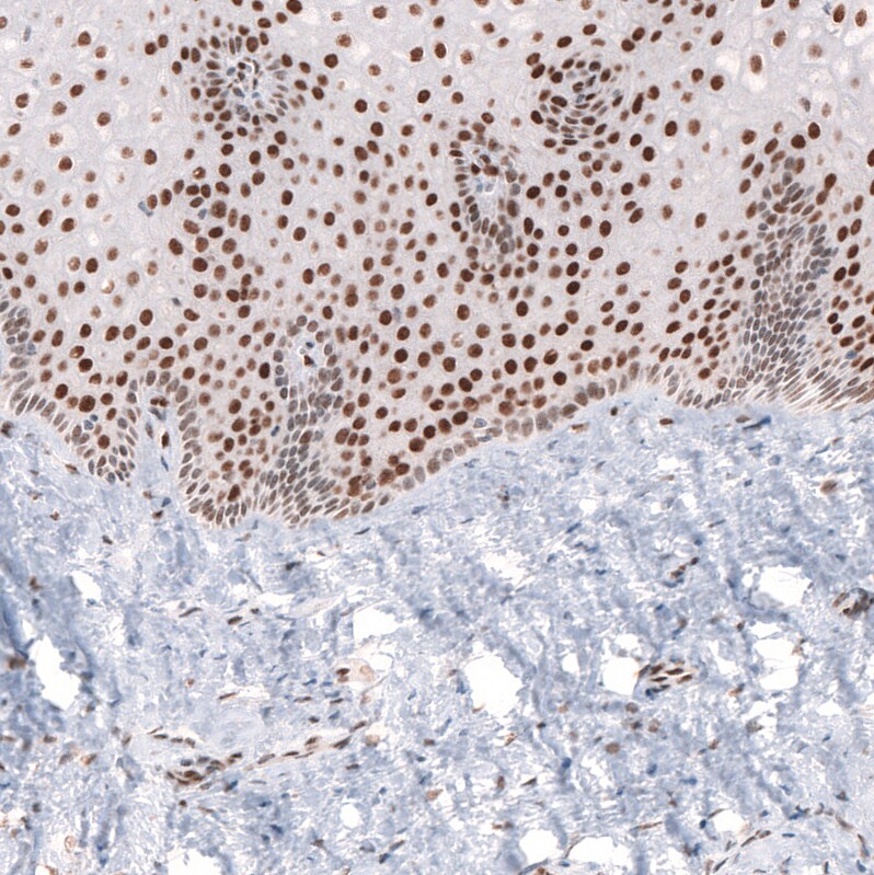 CDP/CUTL1 Antibody (CL5278) Immunohistochemistry: CDP/CUTL1 Antibody (CL5278) [NBP3-52477]