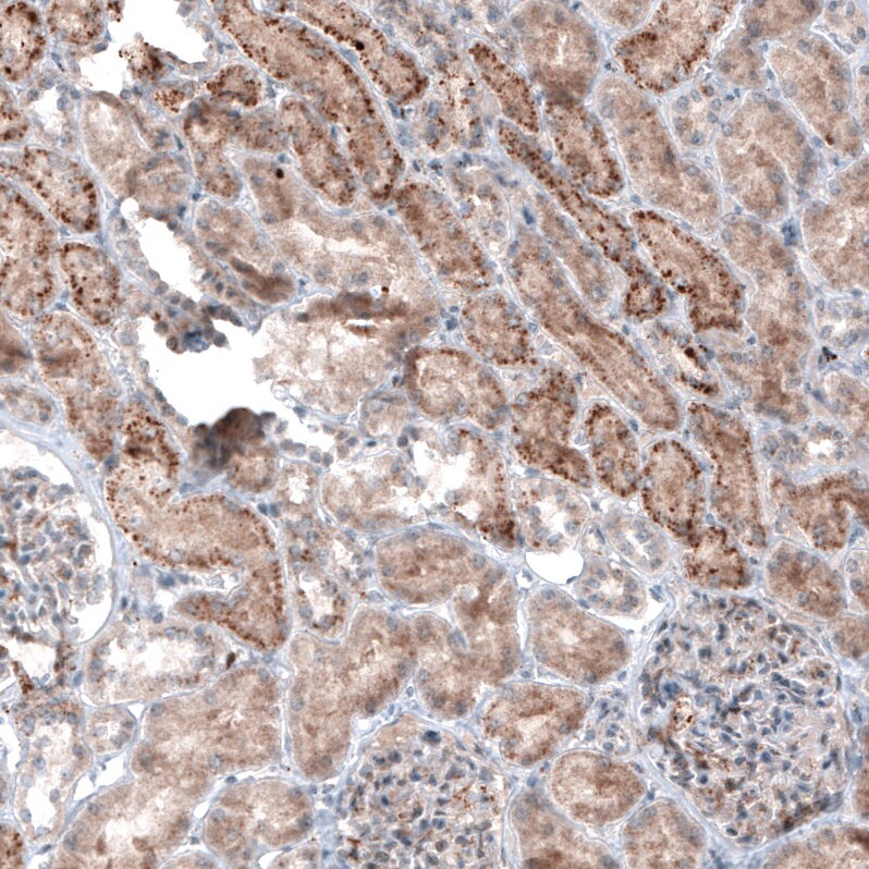 LAPTM4B Antibody (CL5289) Immunohistochemistry: LAPTM4B Antibody (CL5289) [NBP3-52478]