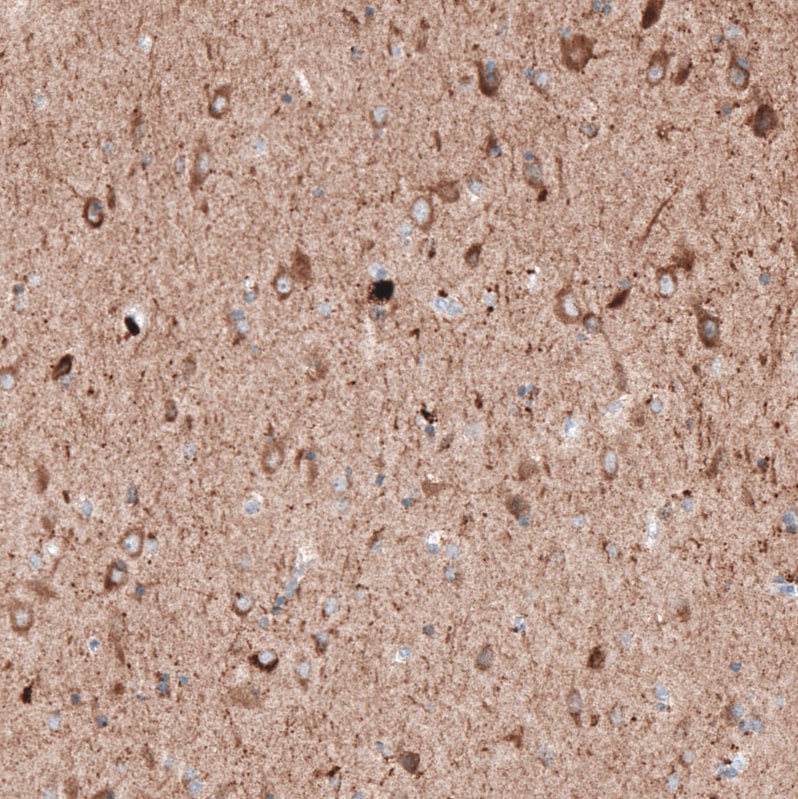 Immunohistochemistry-Paraffin: LAPTM4B Antibody (CL5289) [NBP3-52478]