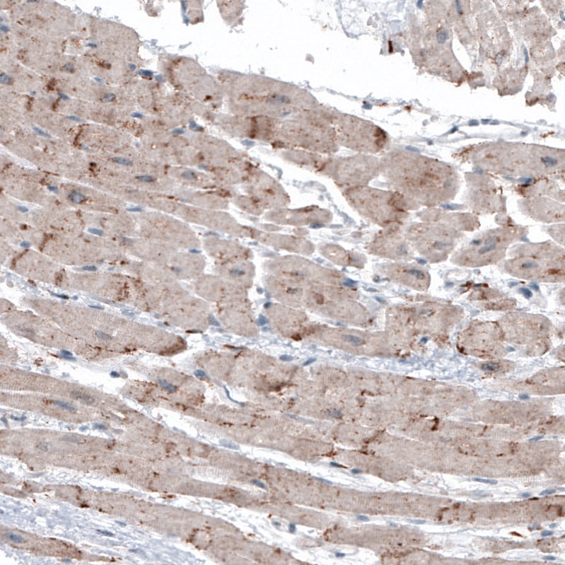 Immunohistochemistry-Paraffin: LAPTM4B Antibody (CL5289) [NBP3-52478]