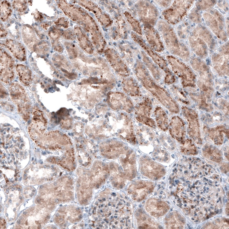 Immunohistochemistry-Paraffin: LAPTM4B Antibody (CL5289) [NBP3-52478]