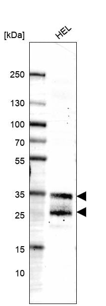 LAPTM4B Antibody (CL5289) Western Blot: LAPTM4B Antibody (CL5289) [NBP3-52478]