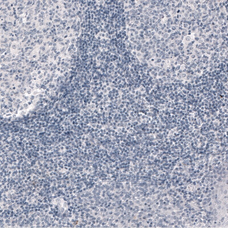 PCP4 Antibody (CL5306) Immunohistochemistry: PCP4 Antibody (CL5306) [NBP3-52479]
