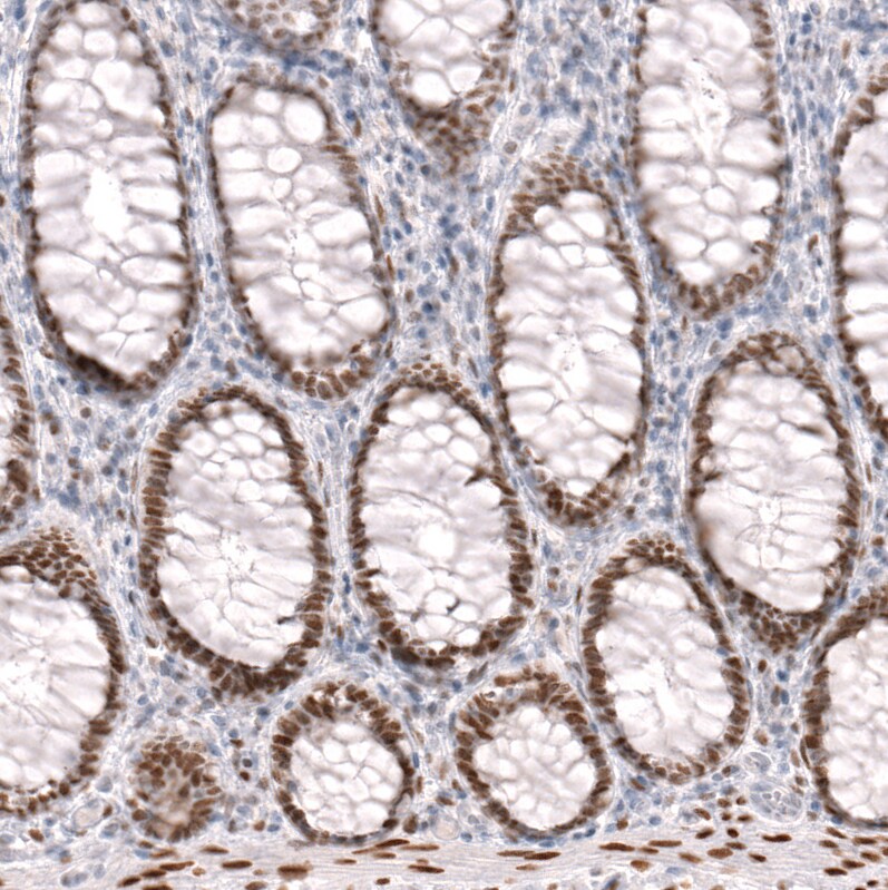FoxP2 Antibody (CL5312) Immunohistochemistry: FoxP2 Antibody (CL5312) [NBP3-52480]