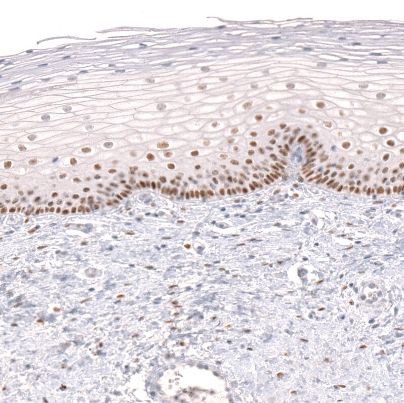 FoxP2 Antibody (CL5312) Immunohistochemistry: FoxP2 Antibody (CL5312) [NBP3-52480]