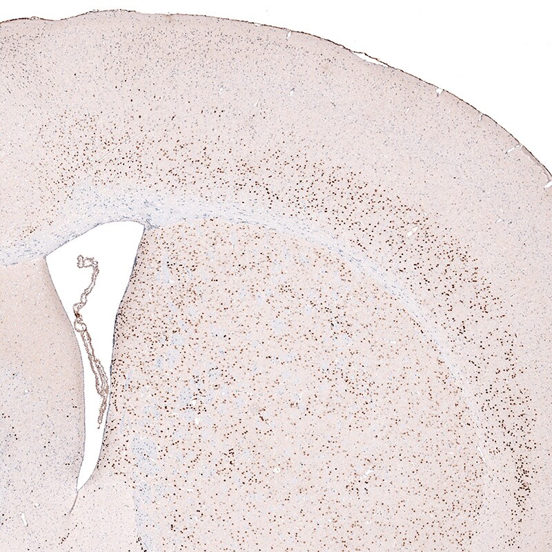 FoxP2 Antibody (CL5312) Immunohistochemistry: FoxP2 Antibody (CL5312) [NBP3-52480]