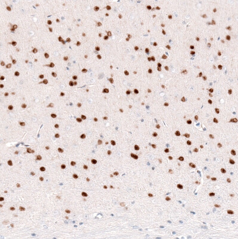 FoxP2 Antibody (CL5312) Immunohistochemistry: FoxP2 Antibody (CL5312) [NBP3-52480]