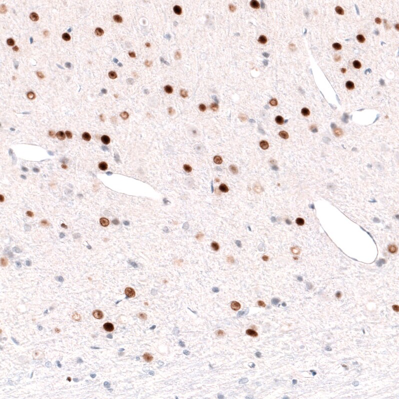 FoxP2 Antibody (CL5312) Immunohistochemistry: FoxP2 Antibody (CL5312) [NBP3-52480]