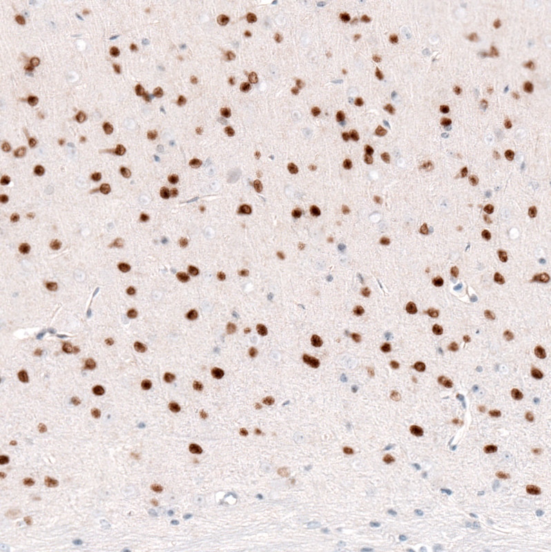 Immunohistochemistry-Paraffin: FoxP2 Antibody (CL5312) [NBP3-52480]