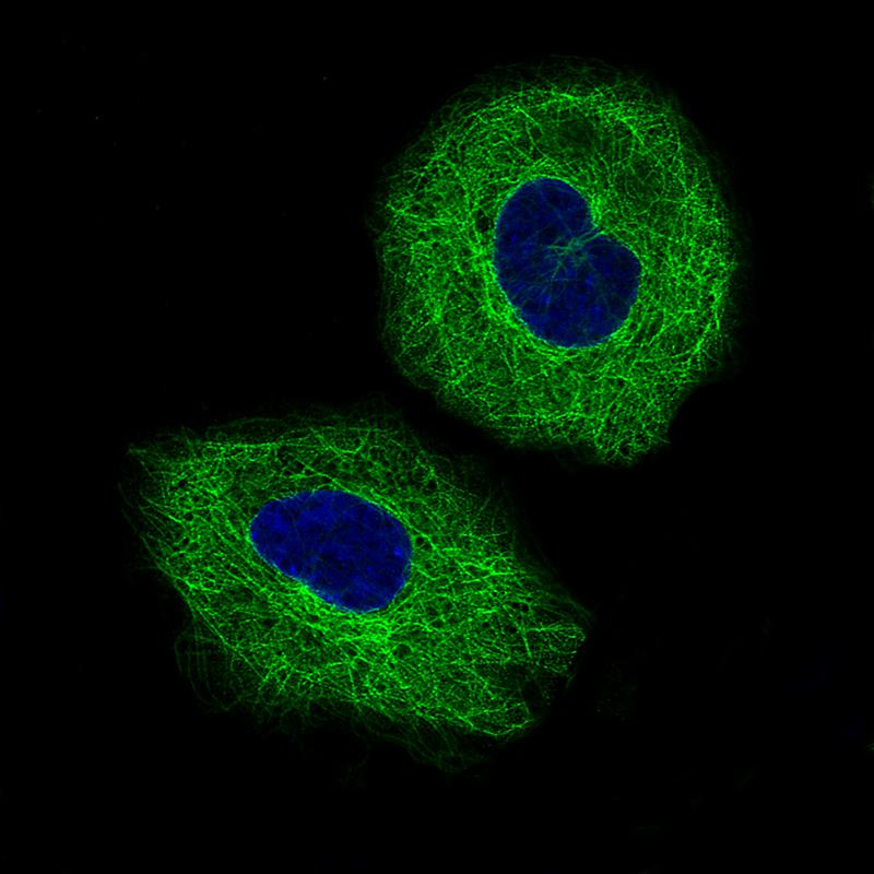 beta-III Tubulin Antibody (CL5813) Immunocytochemistry/ Immunofluorescence: beta-III Tubulin Antibody (CL5813) [NBP3-52481]