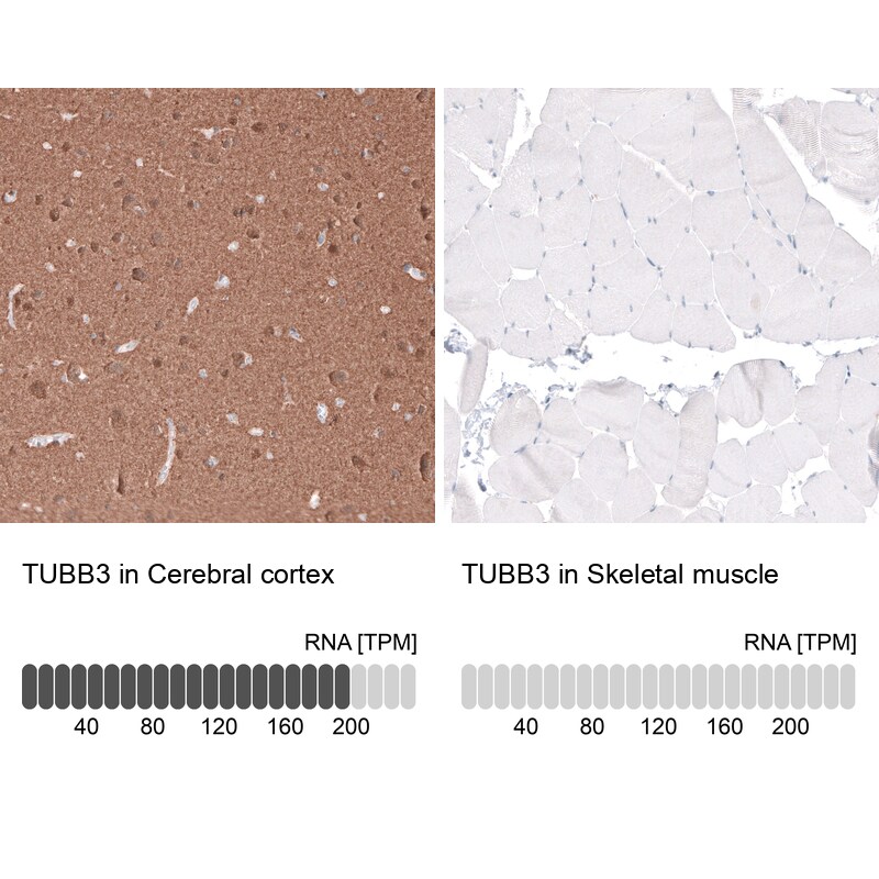 beta-III Tubulin Antibody (CL5813) Immunohistochemistry: beta-III Tubulin Antibody (CL5813) [NBP3-52481]
