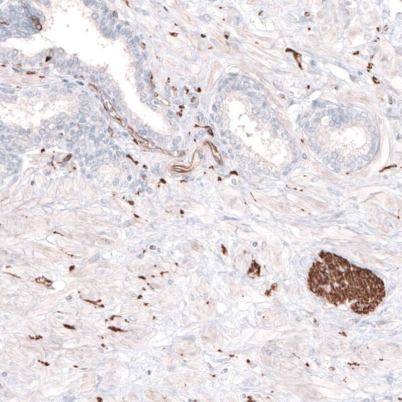 beta-III Tubulin Antibody (CL5813) Immunohistochemistry: beta-III Tubulin Antibody (CL5813) [NBP3-52481]