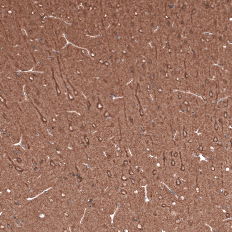 beta-III Tubulin Antibody (CL5813) Immunohistochemistry: beta-III Tubulin Antibody (CL5813) [NBP3-52481]