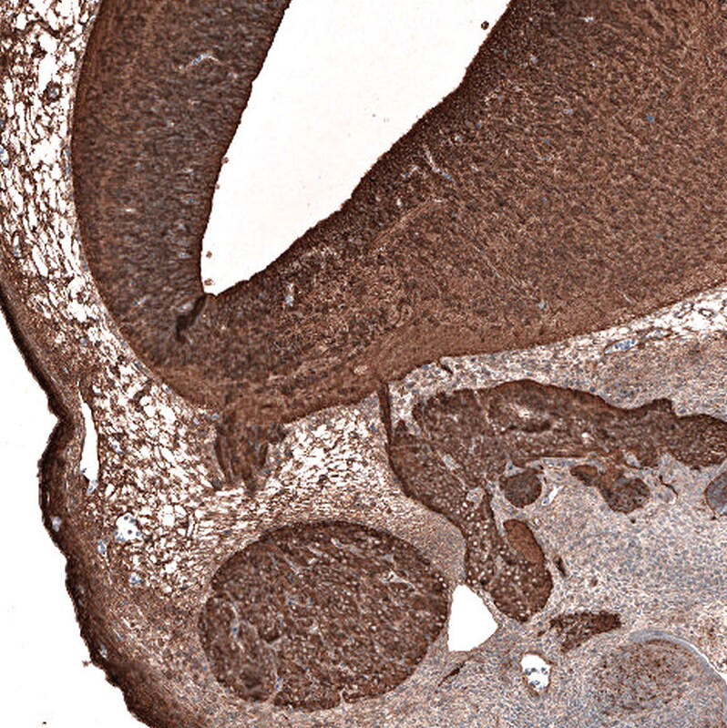 beta-III Tubulin Antibody (CL5813) Immunohistochemistry: beta-III Tubulin Antibody (CL5813) [NBP3-52481]