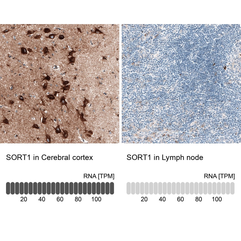Sortilin Antibody (CL6526) Immunohistochemistry: Sortilin Antibody (CL6526) [NBP3-52483]