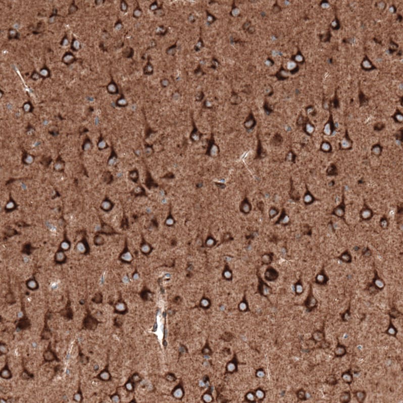 Sortilin Antibody (CL6526) Immunohistochemistry: Sortilin Antibody (CL6526) [NBP3-52483]
