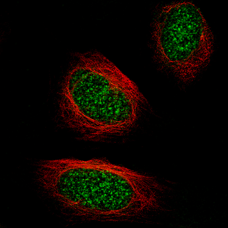 Immunocytochemistry/ Immunofluorescence: TET2 Antibody (CL6873) [NBP3-52484]