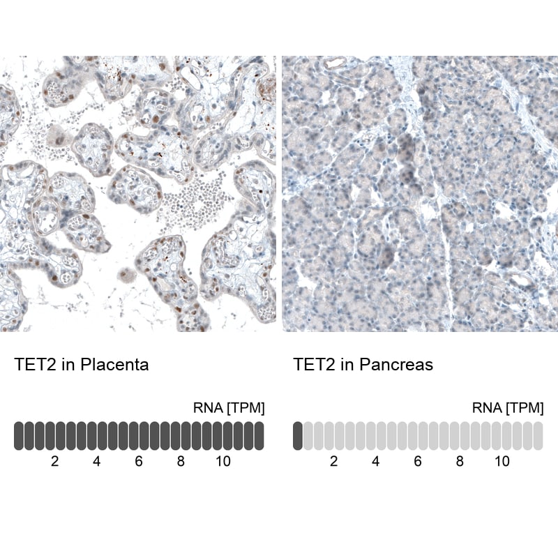 TET2 Antibody (CL6873) Immunohistochemistry: TET2 Antibody (CL6873) [NBP3-52484]