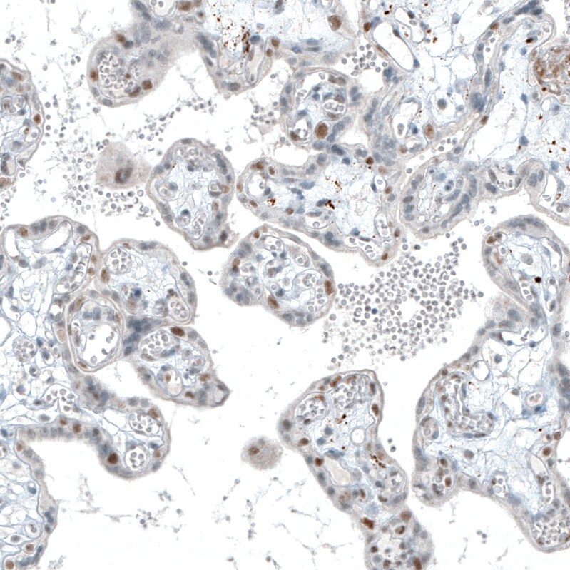 TET2 Antibody (CL6873) Immunohistochemistry: TET2 Antibody (CL6873) [NBP3-52484]