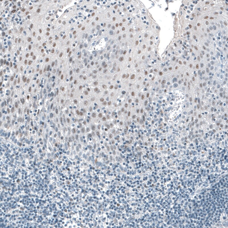 TET2 Antibody (CL6873) Immunohistochemistry: TET2 Antibody (CL6873) [NBP3-52484]