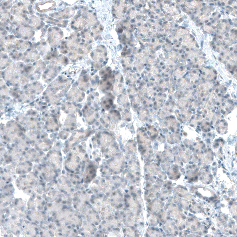 Immunohistochemistry-Paraffin: TET2 Antibody (CL6873) [NBP3-52484]