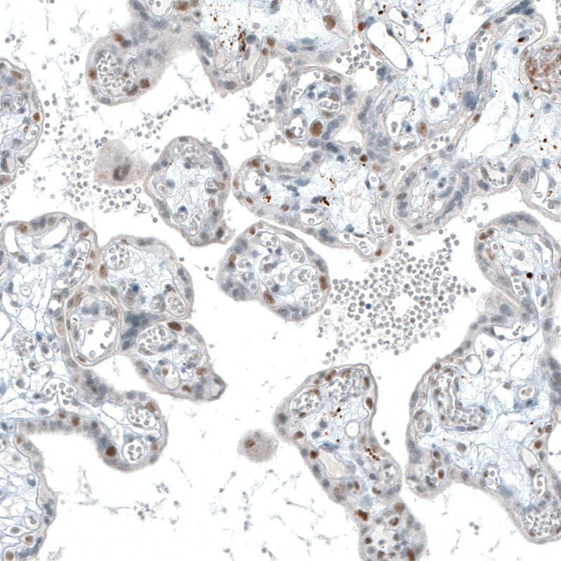 Immunohistochemistry-Paraffin: TET2 Antibody (CL6873) [NBP3-52484]
