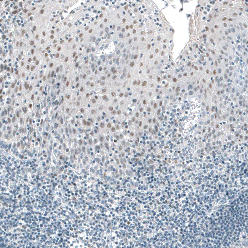 Immunohistochemistry-Paraffin: TET2 Antibody (CL6873) [NBP3-52484]
