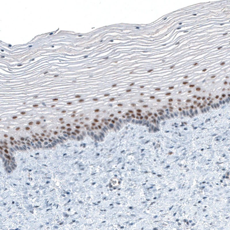 Immunohistochemistry-Paraffin: TET2 Antibody (CL6873) [NBP3-52484]