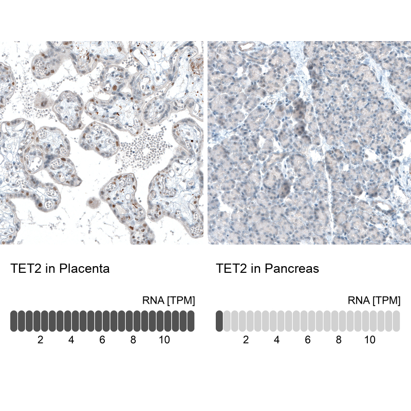 Immunohistochemistry-Paraffin: TET2 Antibody (CL6873) [NBP3-52484]