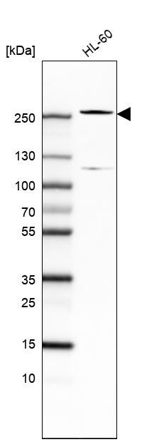 Western Blot: TET2 Antibody (CL6873) [NBP3-52484]