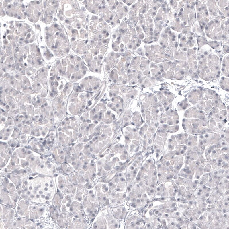 Pax2 Antibody (CL9469) Immunohistochemistry: Pax2 Antibody (CL9469) [NBP3-52485]