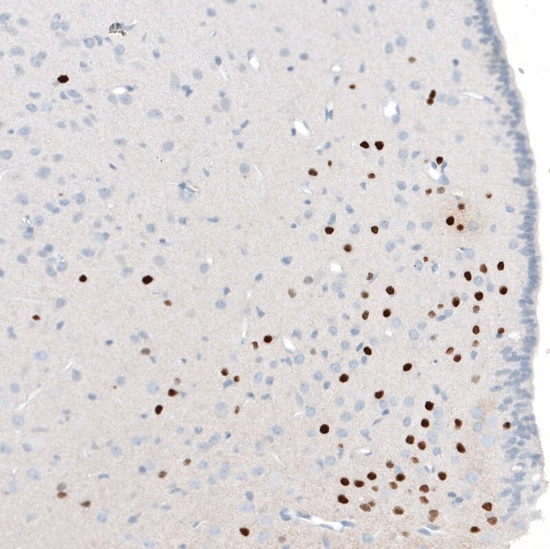 OTP Antibody (CL11222) Immunohistochemistry: OTP Antibody (CL11222) [NBP3-52486]