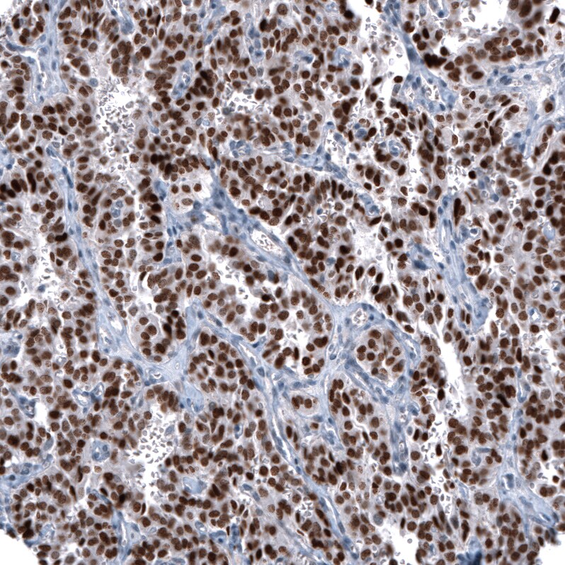 Immunohistochemistry-Paraffin: OTP Antibody (CL11222) [NBP3-52486]
