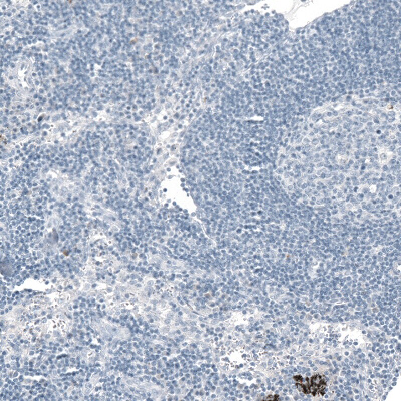 Immunohistochemistry-Paraffin: OTP Antibody (CL11222) [NBP3-52486]