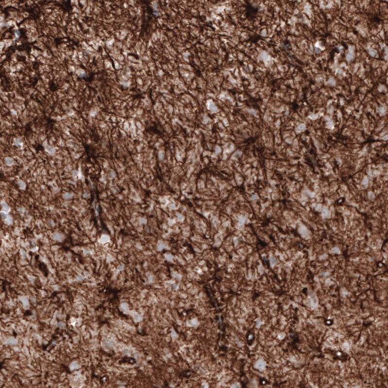 GFAP Antibody (CL2713) Immunohistochemistry: GFAP Antibody (CL2713) [NBP3-52487]