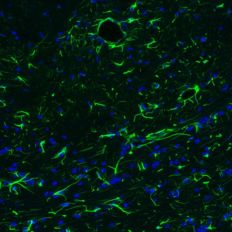 GFAP Antibody (CL2713) Immunohistochemistry: GFAP Antibody (CL2713) [NBP3-52487]