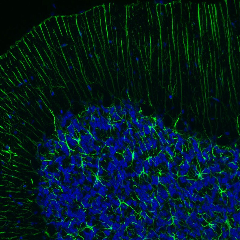 GFAP Antibody (CL2713) Immunohistochemistry: GFAP Antibody (CL2713) [NBP3-52487]