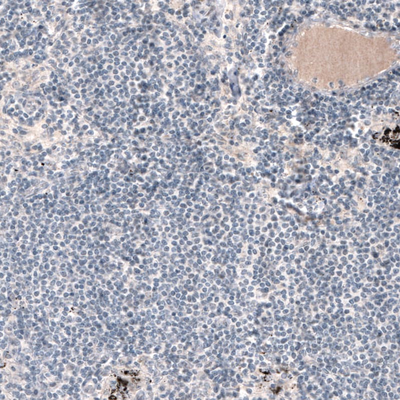 Laminin alpha 1 Antibody (CL3087) Immunohistochemistry: Laminin alpha 1 Antibody (CL3087) [NBP3-52488]