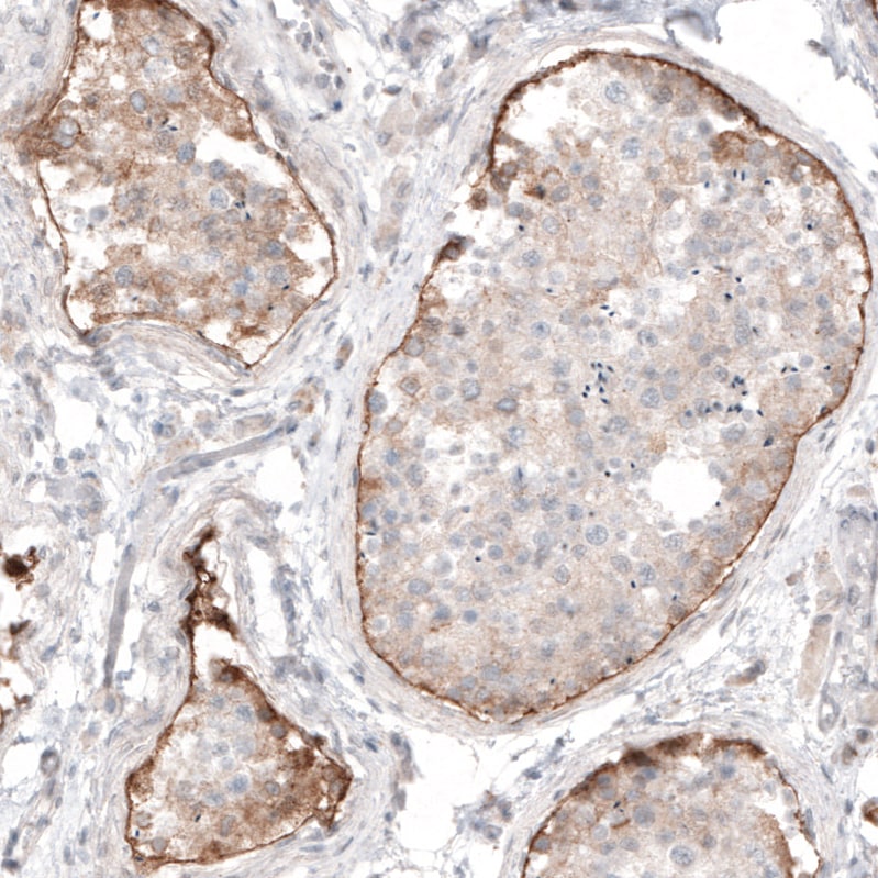 Laminin alpha 1 Antibody (CL3087) Immunohistochemistry: Laminin alpha 1 Antibody (CL3087) [NBP3-52488]