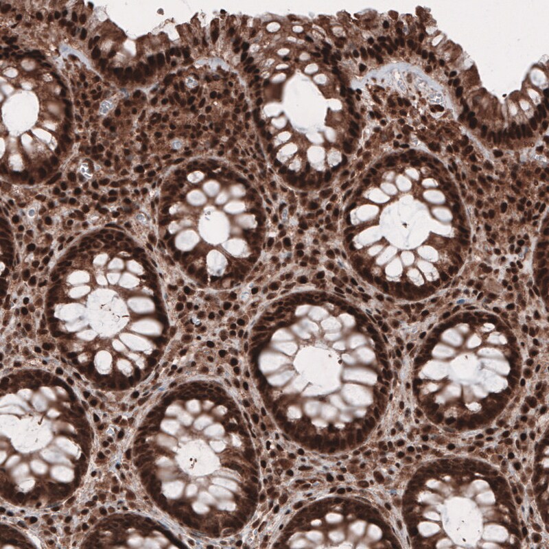 GAPDH Antibody (CL3265) Immunohistochemistry: GAPDH Antibody (CL3265) [NBP3-52489]
