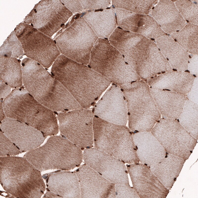 GAPDH Antibody (CL3265) Immunohistochemistry: GAPDH Antibody (CL3265) [NBP3-52489]