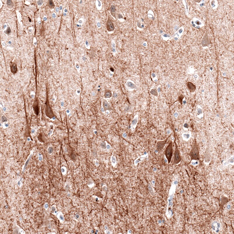 MAP2 Antibody (CL5420) Immunohistochemistry: MAP2 Antibody (CL5420) [NBP3-52490]