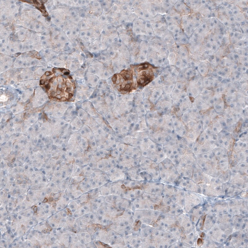 MAP2 Antibody (CL5420) Immunohistochemistry: MAP2 Antibody (CL5420) [NBP3-52490]
