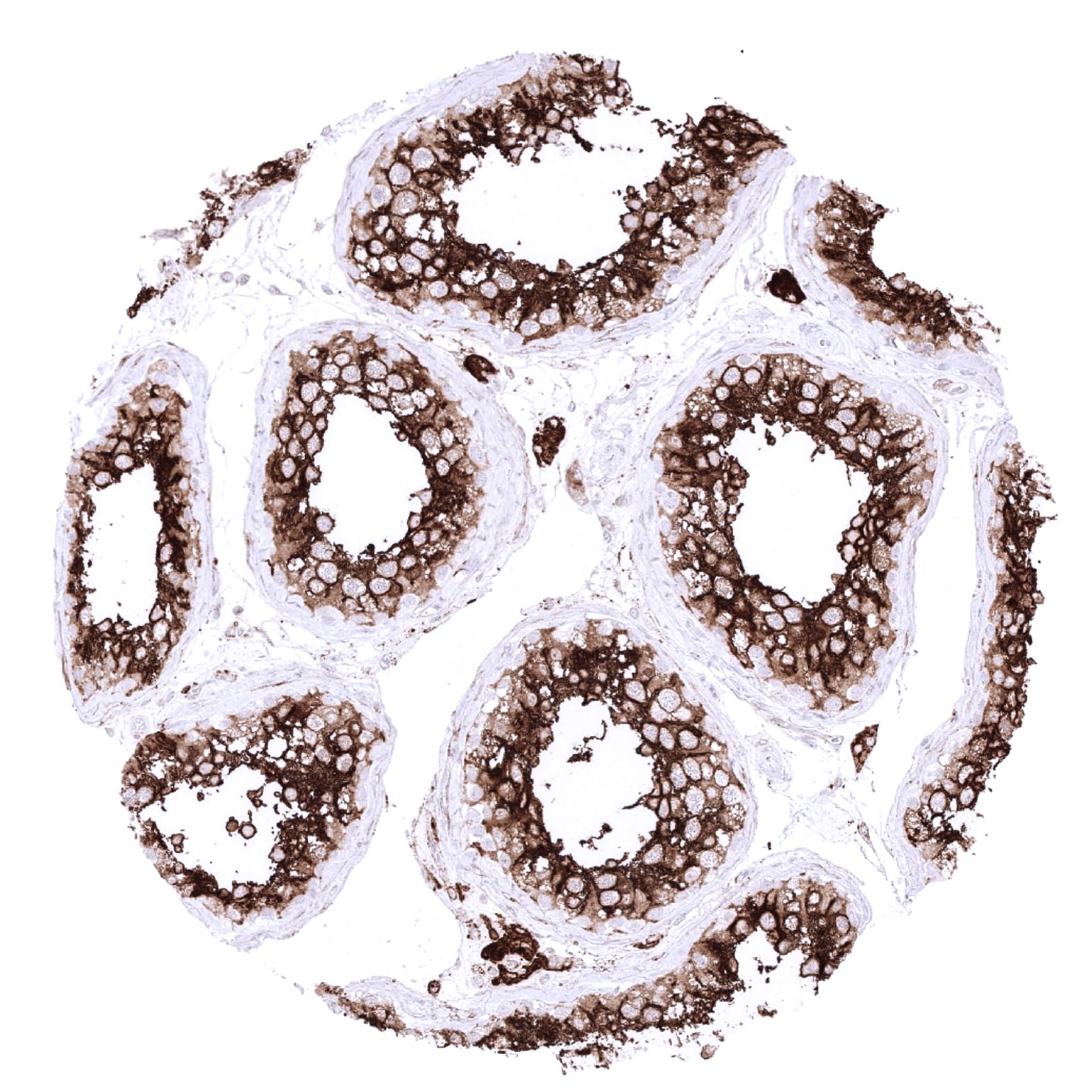 ACE-2 Antibody (MSVA-919R) Immunohistochemistry: ACE-2 Antibody (MSVA-919R) [NBP3-52491]
