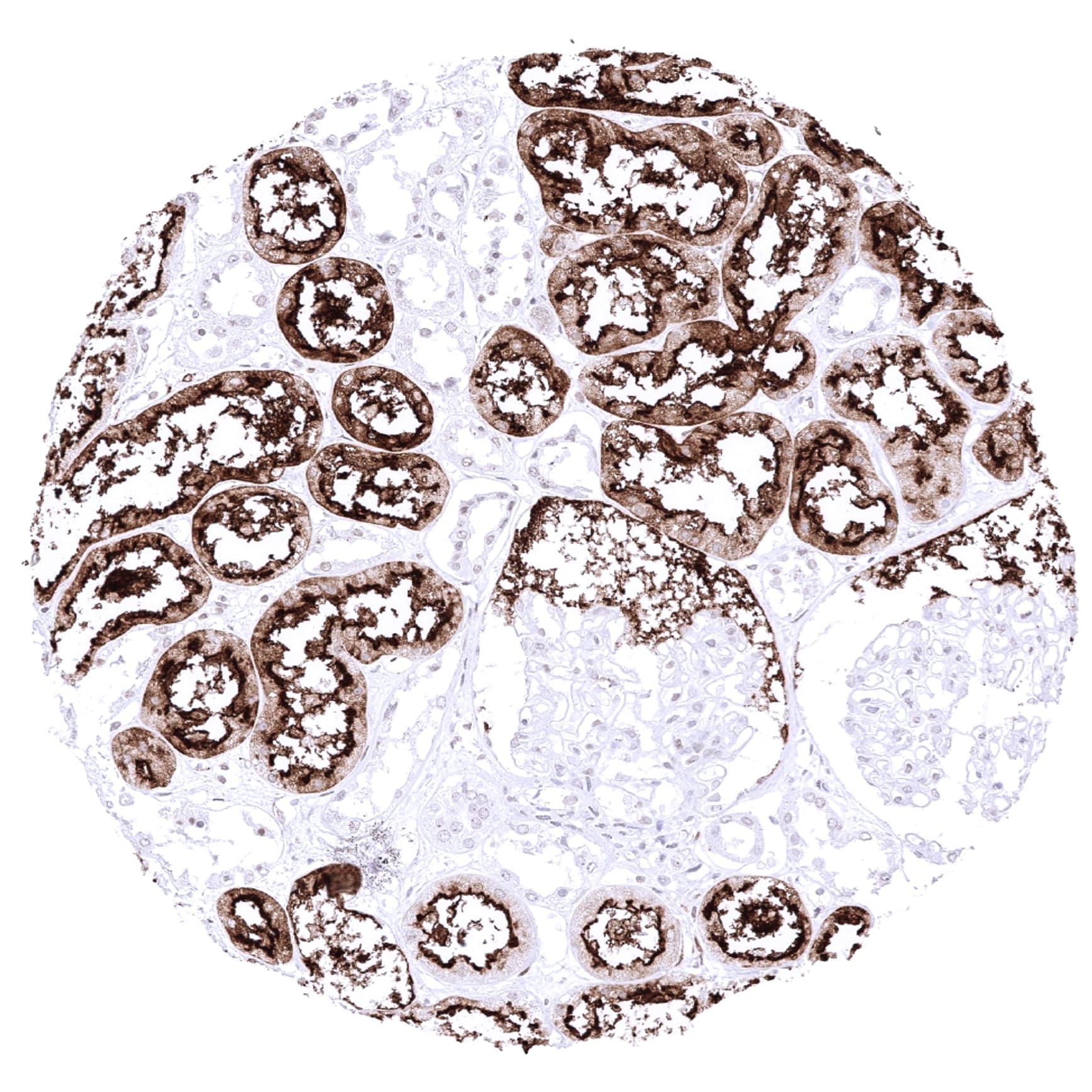 ACE-2 Antibody (MSVA-919R) Immunohistochemistry: ACE-2 Antibody (MSVA-919R) [NBP3-52491]