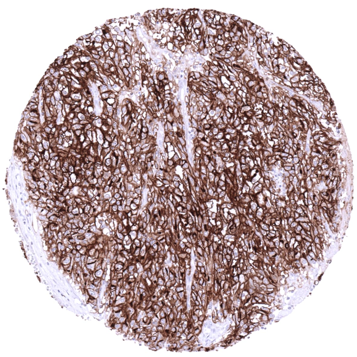 ACE-2 Antibody (MSVA-919R) Immunohistochemistry: ACE-2 Antibody (MSVA-919R) [NBP3-52491]