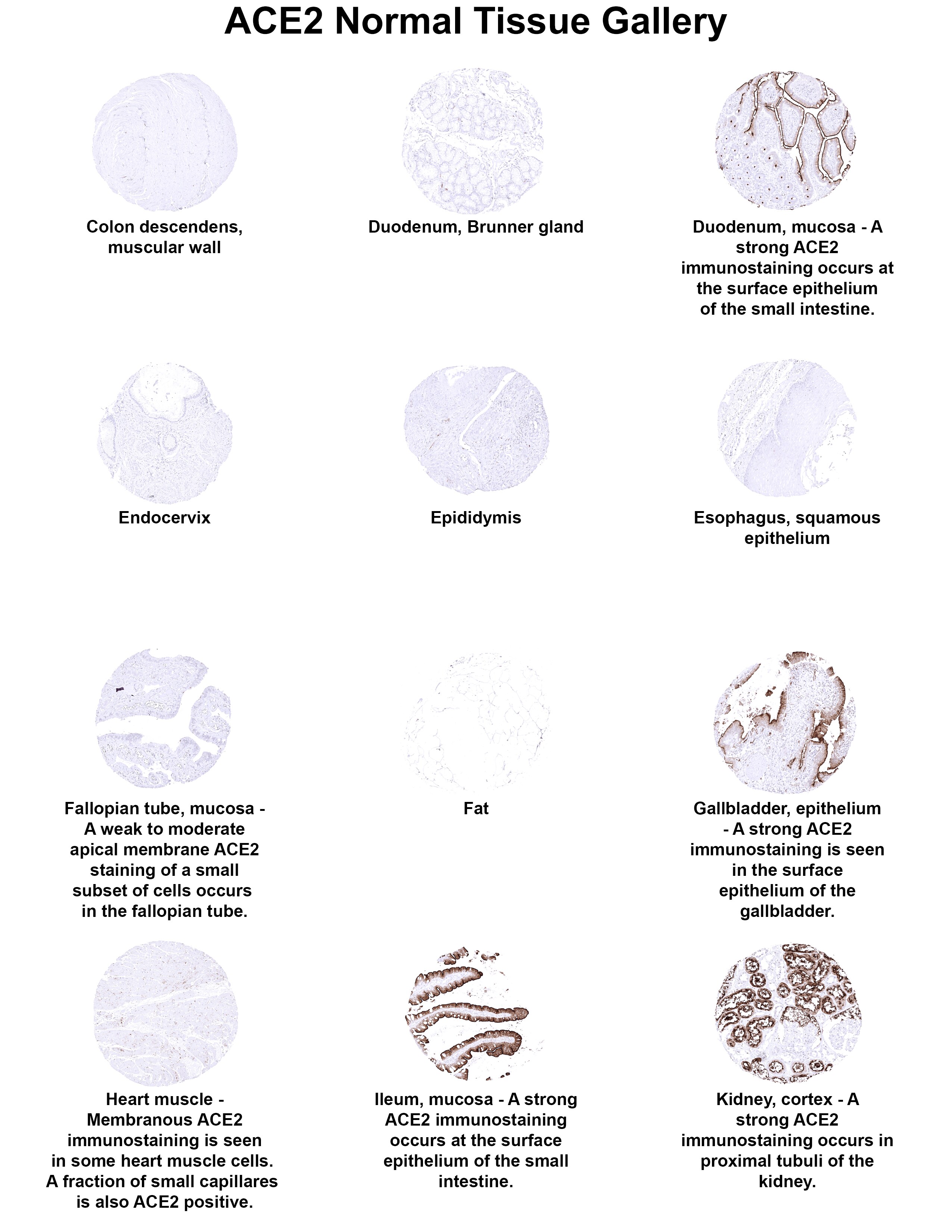 ACE-2 Antibody (MSVA-919R) ACE2 Normal Tissue Gallery