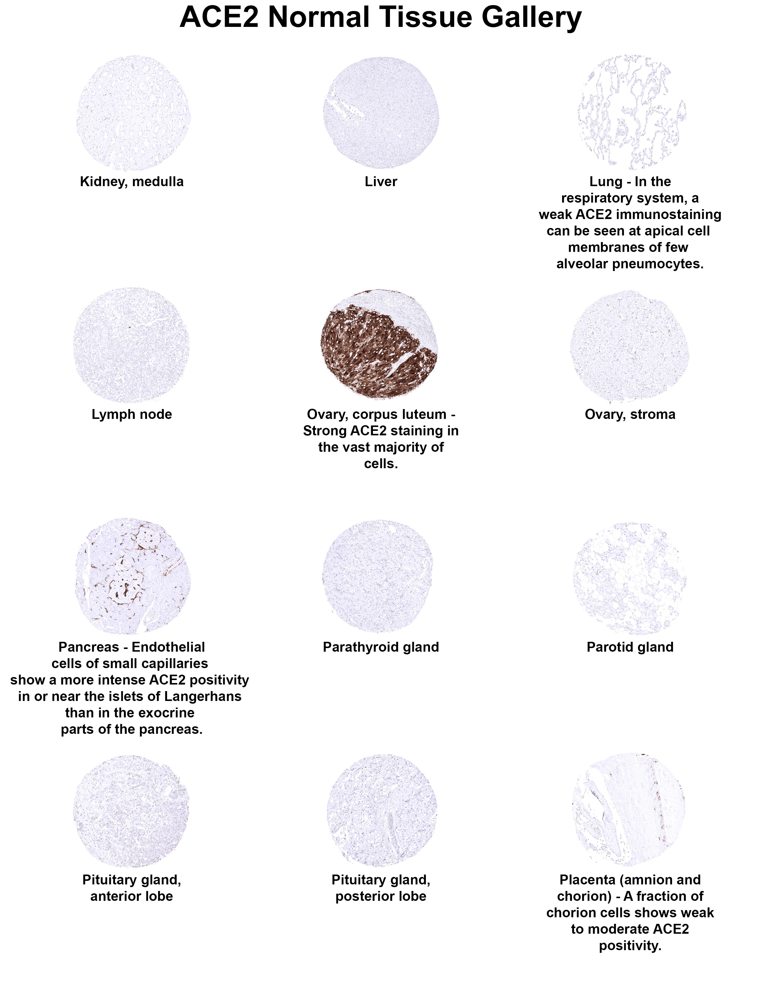 ACE-2 Antibody (MSVA-919R) ACE2 Normal Tissue Gallery