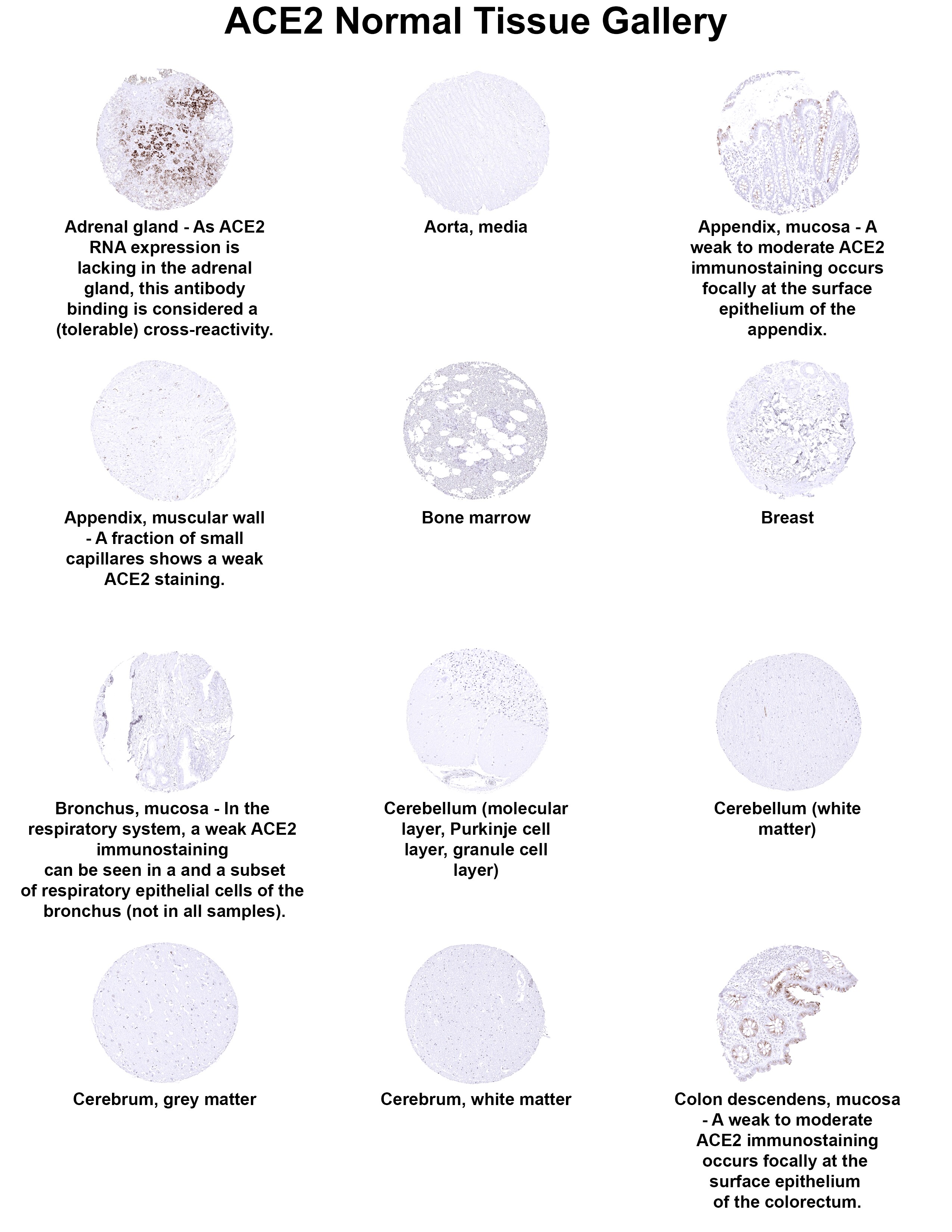 ACE-2 Antibody (MSVA-919R) - Azide and BSA Free ACE2 Normal Tissue Gallery