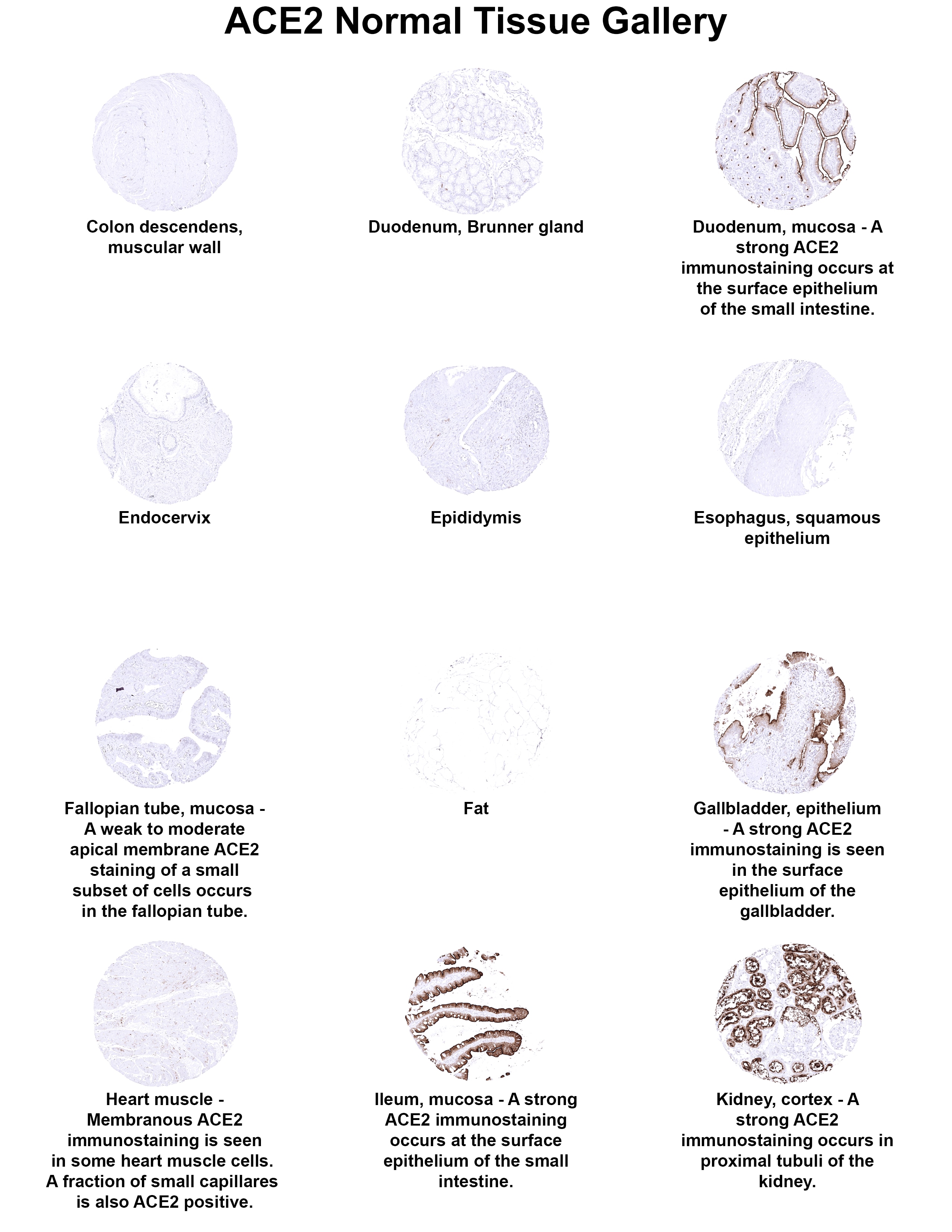 ACE-2 Antibody (MSVA-919R) - Azide and BSA Free ACE2 Normal Tissue Gallery